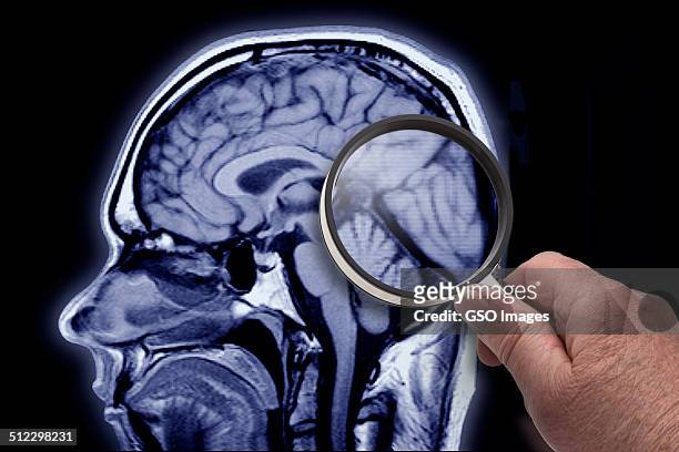 memory doubts - brain scan stock-fotos und bilder