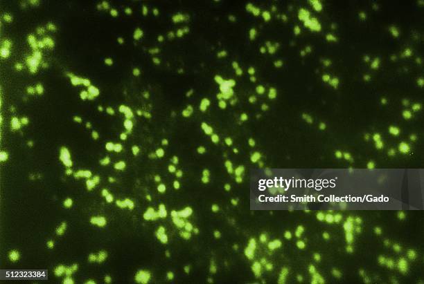 Neisseria meningitidis, group C, in spinal fluid, Neisseria meningitidis, group C, in spinal fluid FA stain . Image courtesy CDC/Dr MS Mitchell,...