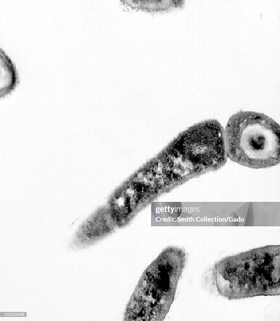 Bacillus anthracis