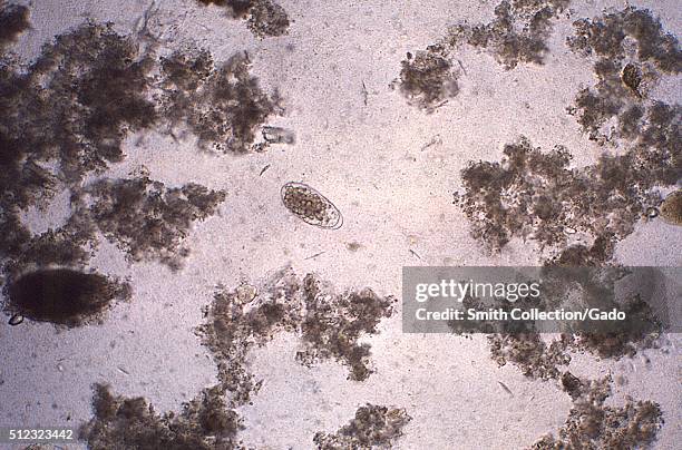 Fertilized, decorticated Ascaris lumbricoides egg. Image courtesy CDC/Dr. Mae Melvin, 1979. .