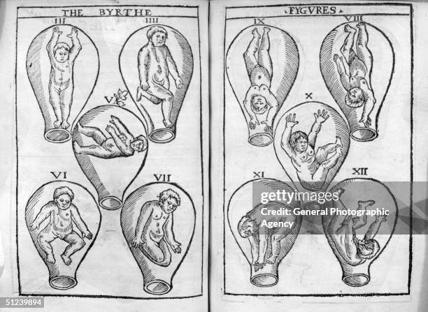 Circa 1650, Diagrams from a 17th century medical volume illustrating the various positions of a foetus within the womb.