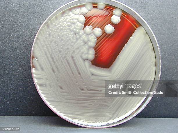 Bacillus cereus showing hemolysis on sheep blood agar. B. Cereus is a Gram-positive beta hemolytic bacteria, which may live in an environment with or...