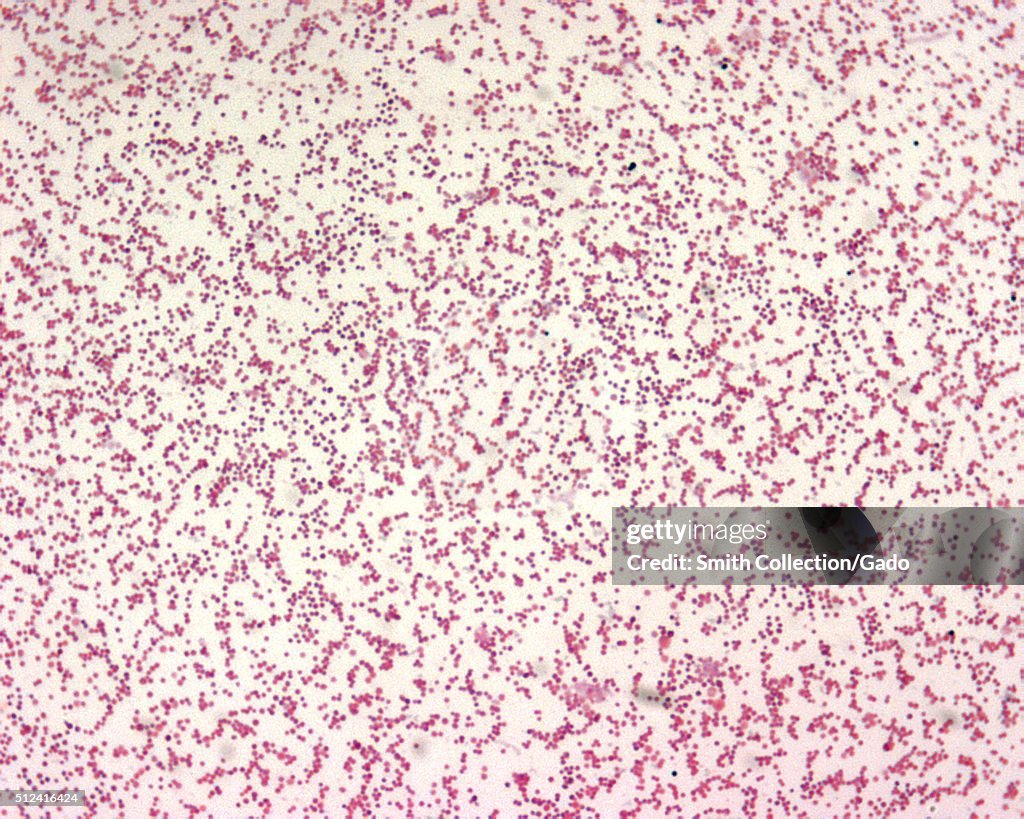 Francisella Tularensis