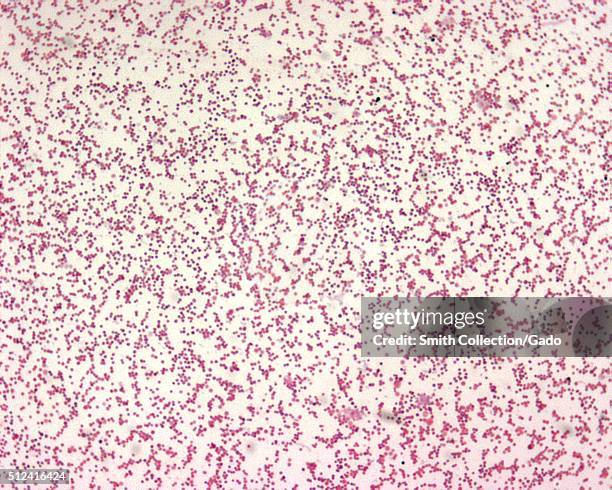 Francisella tularensis is Gram-negative in its staining morphology. Francisella tularensis is a poorly staining, very tiny gram-negative...