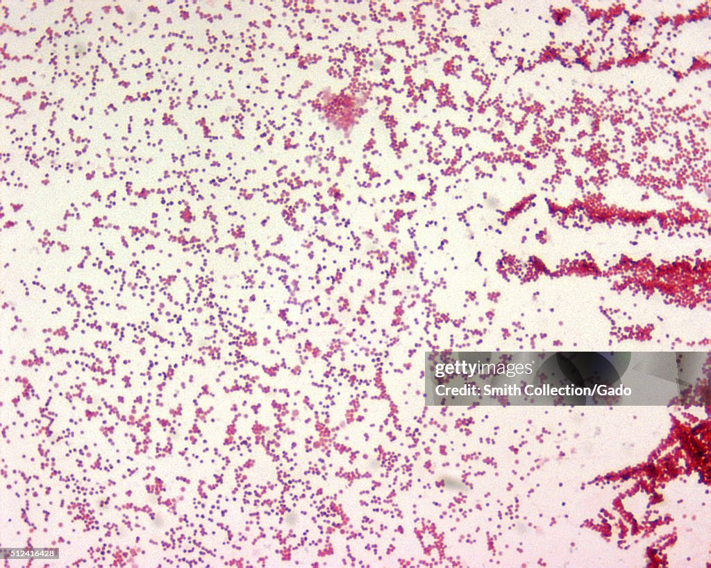 Francisella Tularensis