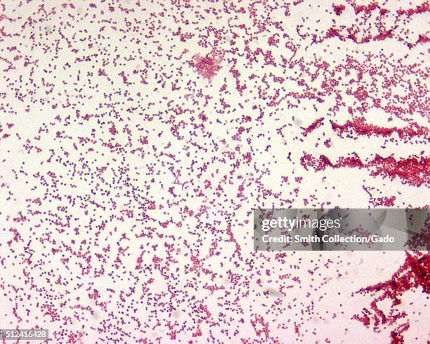 Francisella tularensis is Gram-negative in its staining morphology. Francisella tularensis is a poorly staining, very tiny gram-negative...