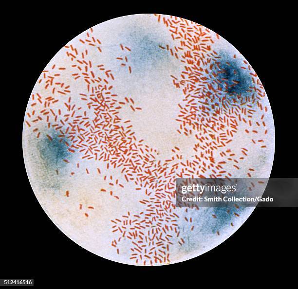 Photomicrograph of Haemophilus influenzae as seen using a Gram-stain technique. During the flu outbreak of 1918 H. Influenzae was termed Pfeiffer's...