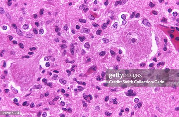 Rabies Inclusions 2,555 Rabies Stock Photos, High-Res Pictures, and Images - Getty Images