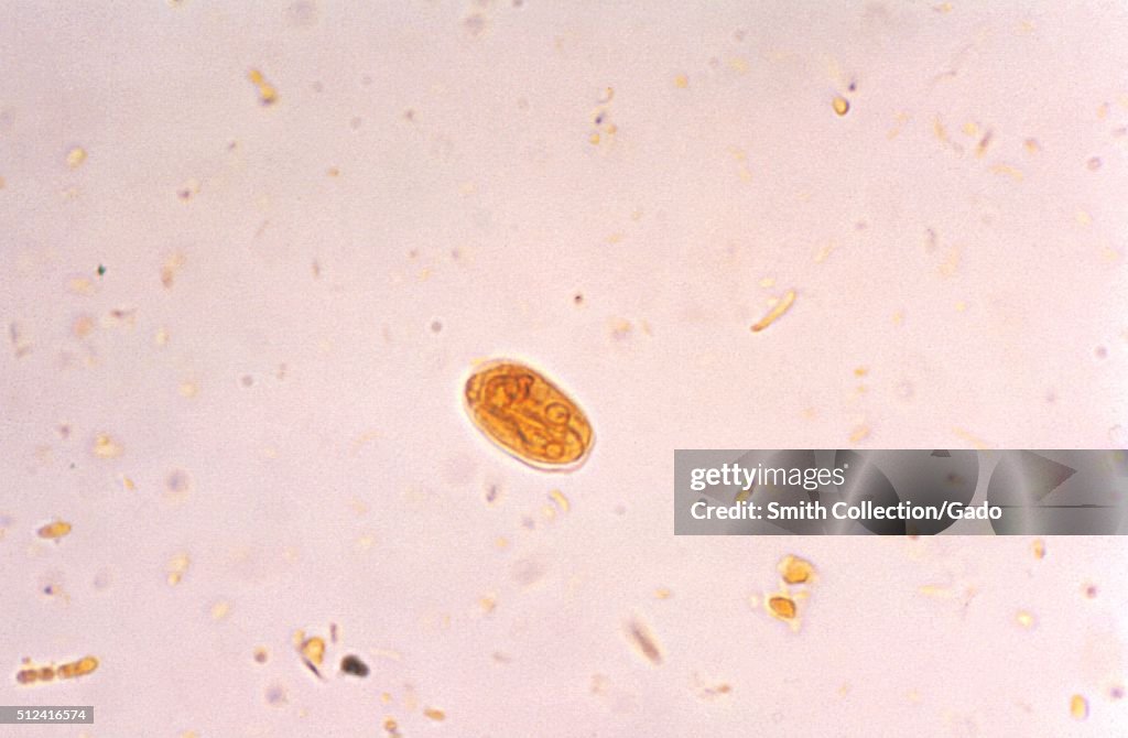 Giardia lamblia cyst