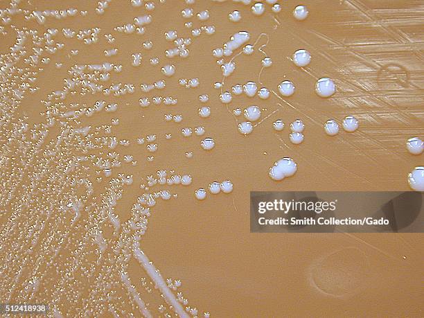 Francisella tularensis, Colonies grown on Chocolate Agar, 72 hours. F. Tularensis, Colony characteristics when grown on Chocolate, Martin Lewis or...