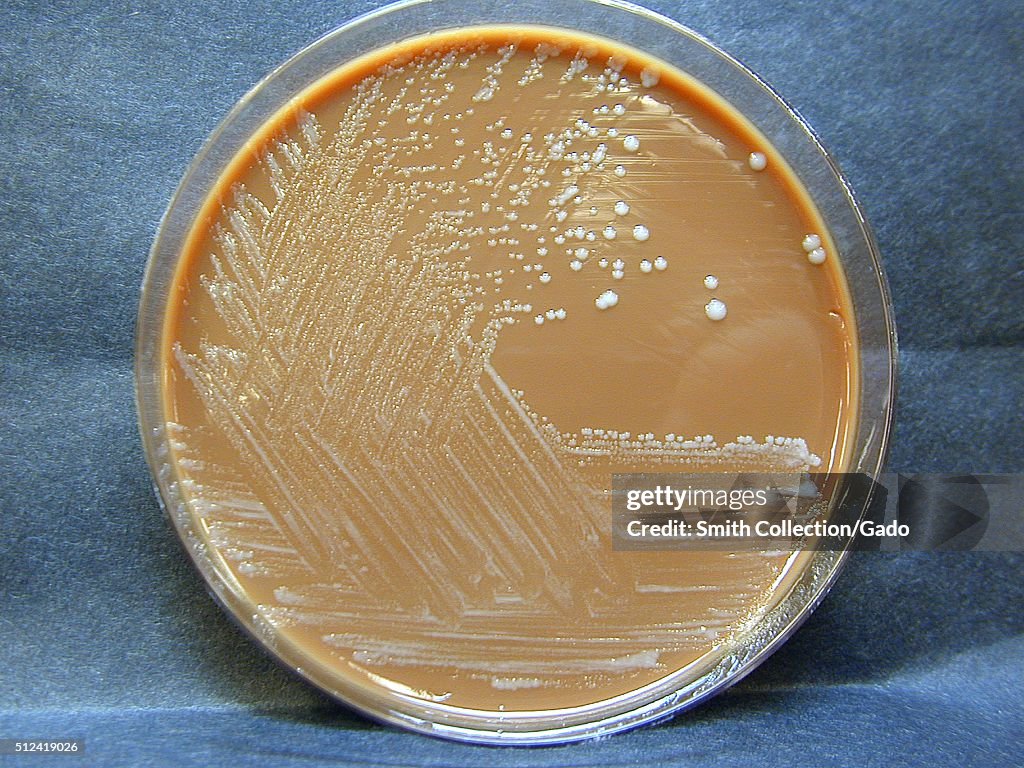 Francisella Tularensis Colonies Grown On Chocolate Agar 72 Hours francisella-tularensis-colonies-grown-on-chocolate-agar-72-hours