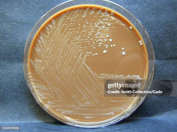 Francisella tularensis, Colonies grown on Chocolate Agar, 72 hours. F. Tularensis, Colony characteristics when grown on Chocolate, Martin Lewis or...