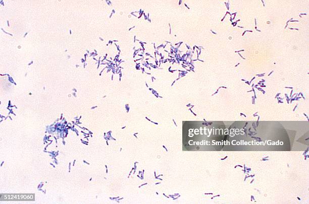 Photomicrograph of Corynebacterium diphtheriae magnified 1200x. Photomicrograph of Corynebacterium diphtheriae magnified 1200x, after growth of Pai...