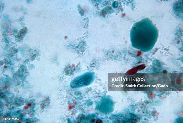 Photomicrograph of a Giardia lamblia cyst seen using a Trichrome stain. Giardia lamblia is the protozoan organism that causes the disease Giardiasis,...