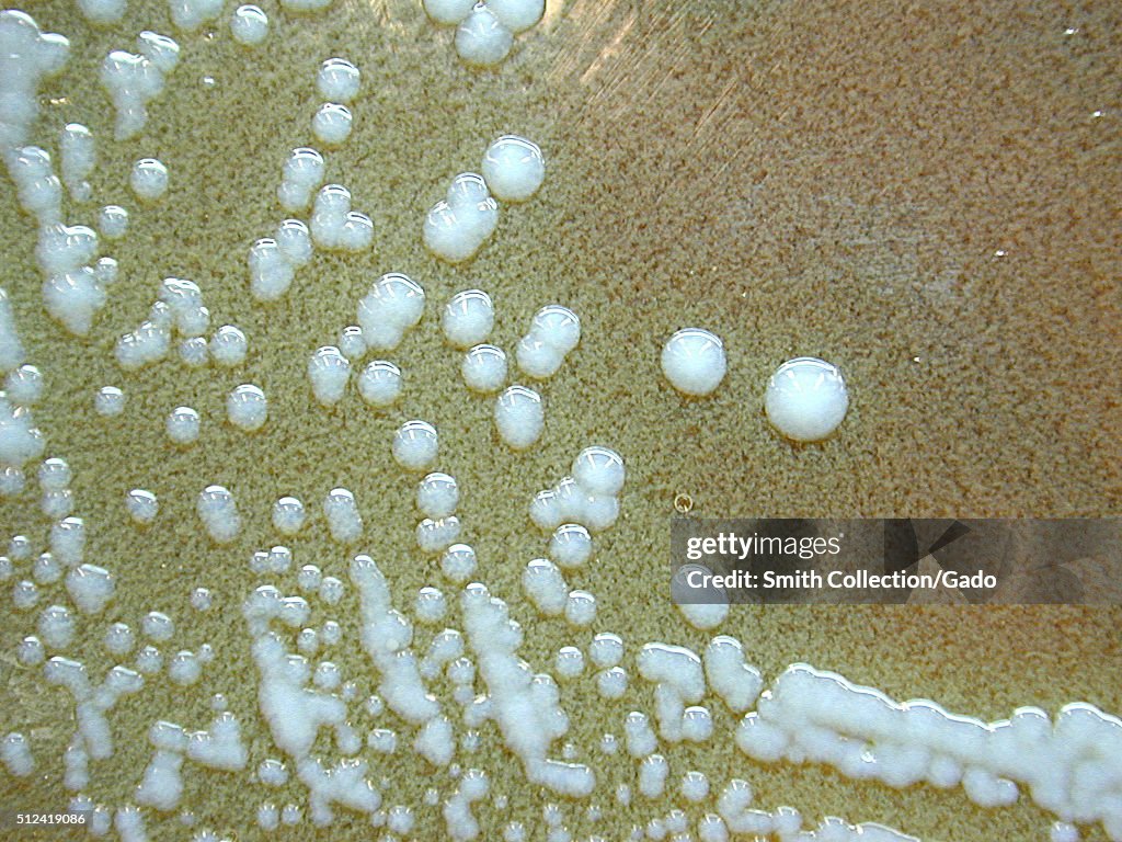 Francisella Tularensis Colonization On Cysteine Heart Agar After 72 francisella-tularensis-colonization-on-cysteine-heart-agar-after-72