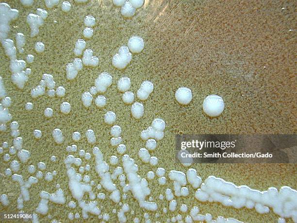 Francisella tularensis, Colonization on Cysteine Heart Agar after 72 hours. F. Tularensis, Colony Characteristics when grown on Cysteine Heart Agar,...