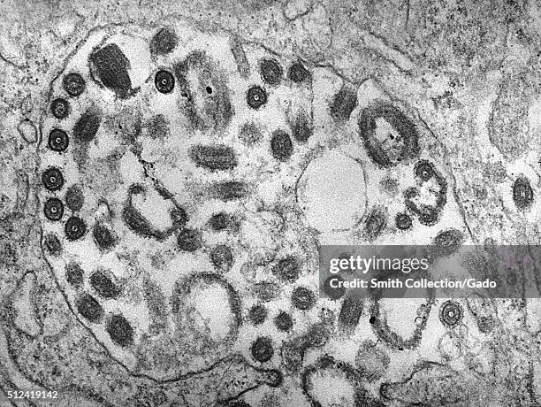 Transmission electron micrograph of the Marburg virus. Marburg virus, first recognized in 1967, causes a severe type of hemorrhagic fever, which...