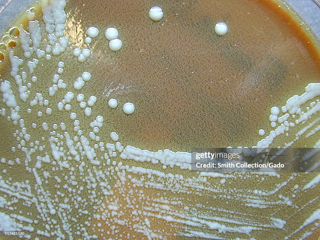 Francisella Tularensis