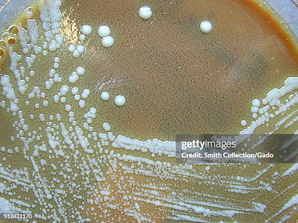 Francisella tularensis, Colonization on Cysteine Heart Agar after 72 hours. F. Tularensis, Colony Characteristics when grown on Cysteine Heart Agar,...