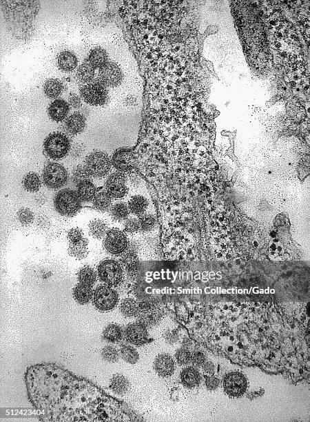 Electron photomicrograph of the Machupo Virus. Machupo Virus is a member of the Arenavirus family, isolated in the Beni province of Bolivia in 1963,...