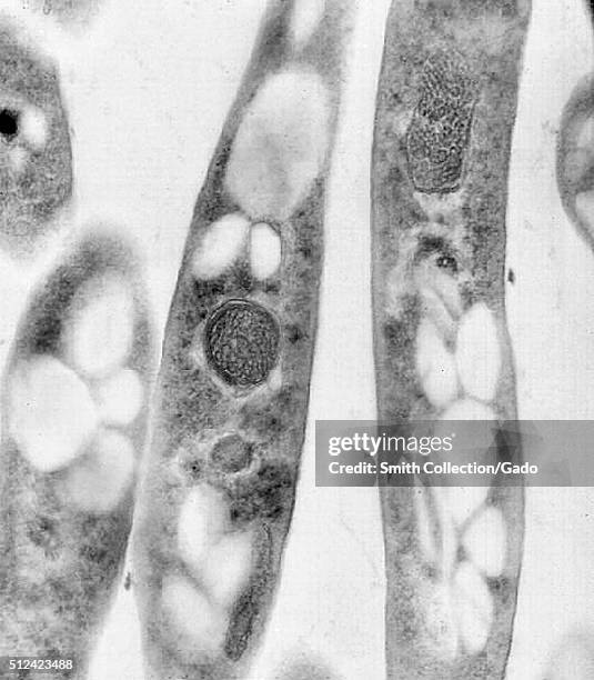 Transmission electron micrograph of Bacillus anthracis. Transmission electron micrographic image of Bacillus anthracis. Image courtesy CDC/Dr. Sherif...