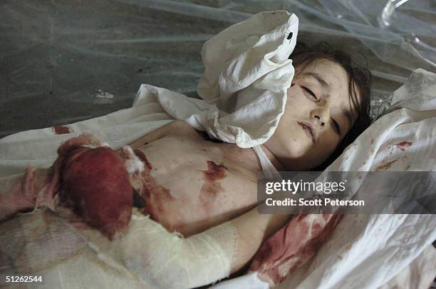 The body of a dead girl, one of 330 known dead, lies in the city mortuary the day after the three-day Russian school siege in Beslan, in which...