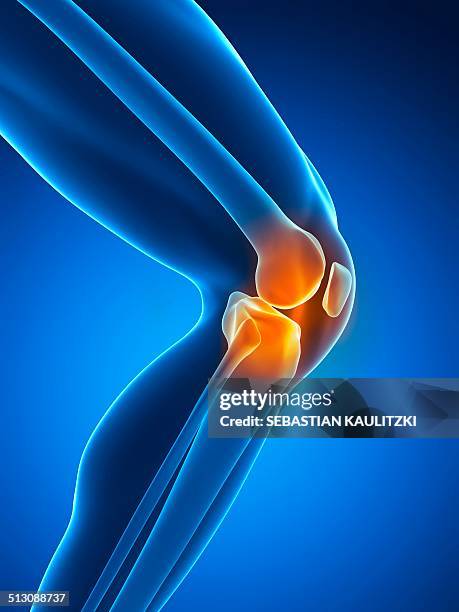 human knee pain, artwork - knee stock illustrations