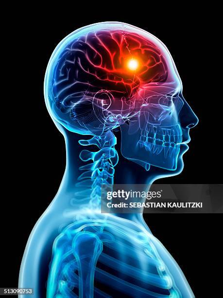 stockillustraties, clipart, cartoons en iconen met human brain anatomy, artwork - hoofdpijn