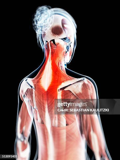 human neck pain, artwork - neck muscle pain illustration stock illustrations