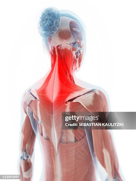 human neck pain, artwork - neck muscle pain illustration stock illustrations
