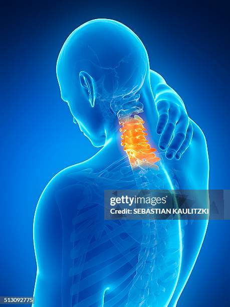 human neck pain, artwork - cervical vertebrae stock illustrations