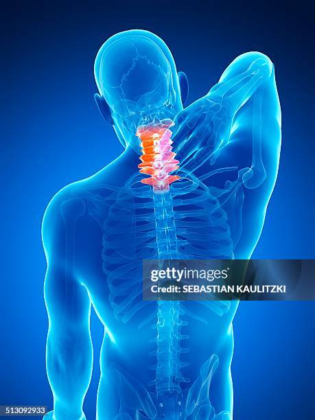 human neck pain, artwork - cervical vertebrae stock illustrations