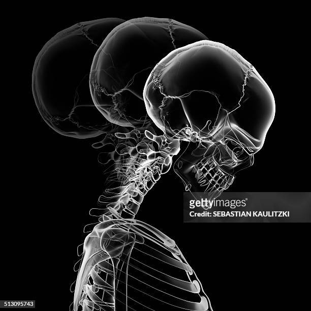 Neck Range Of Motion Photos and Premium High Res Pictures - Getty Images