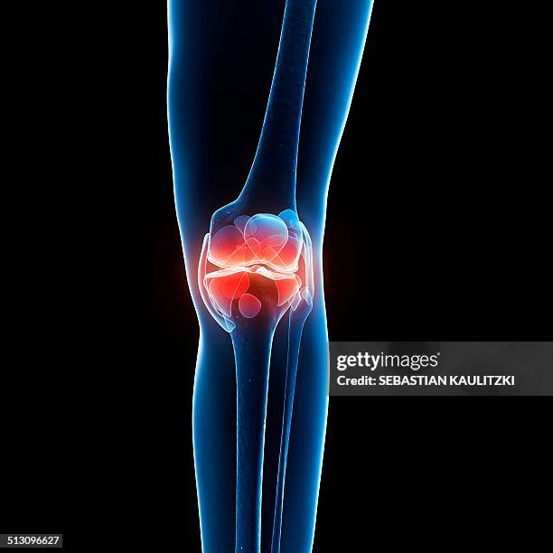 human knee pain, artwork - knee stock illustrations