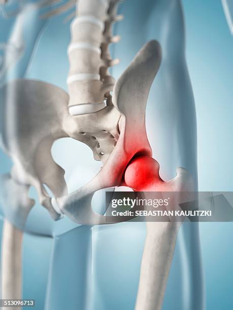human hip pain, artwork - hip body part stock illustrations