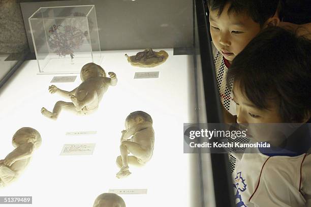 Visitors gaze at a preserved plastomic foetus at the "Mysteries of the Human Body" exhibition which displays some 170 specimens on October 1, 2004 in...