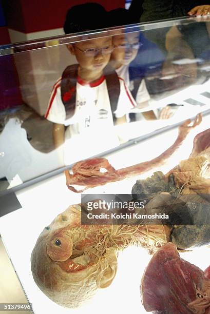 Young visitor gazes at a preserved plastomic Nervous System at the "Mysteries of the Human Body" exhibition which displays some 170 specimens on...