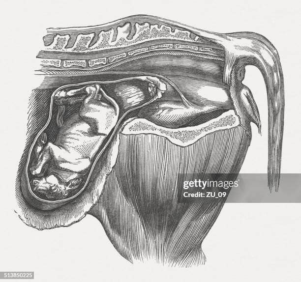 cow fetus: abnormal position, rump supine position, published in 1883 - animal reproductive organ 幅插畫檔、美工圖案、卡通及圖標