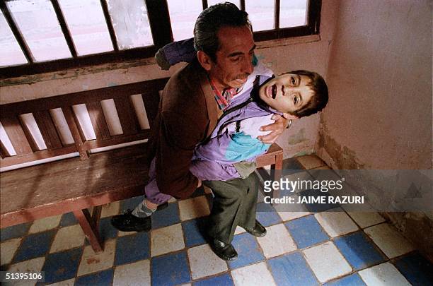 Juan Cuenca holds 19 November 1994 his nine-year-old son Juan Manuel who suffers from multiple birth defects at his home in Oruro, a industry-ringed...