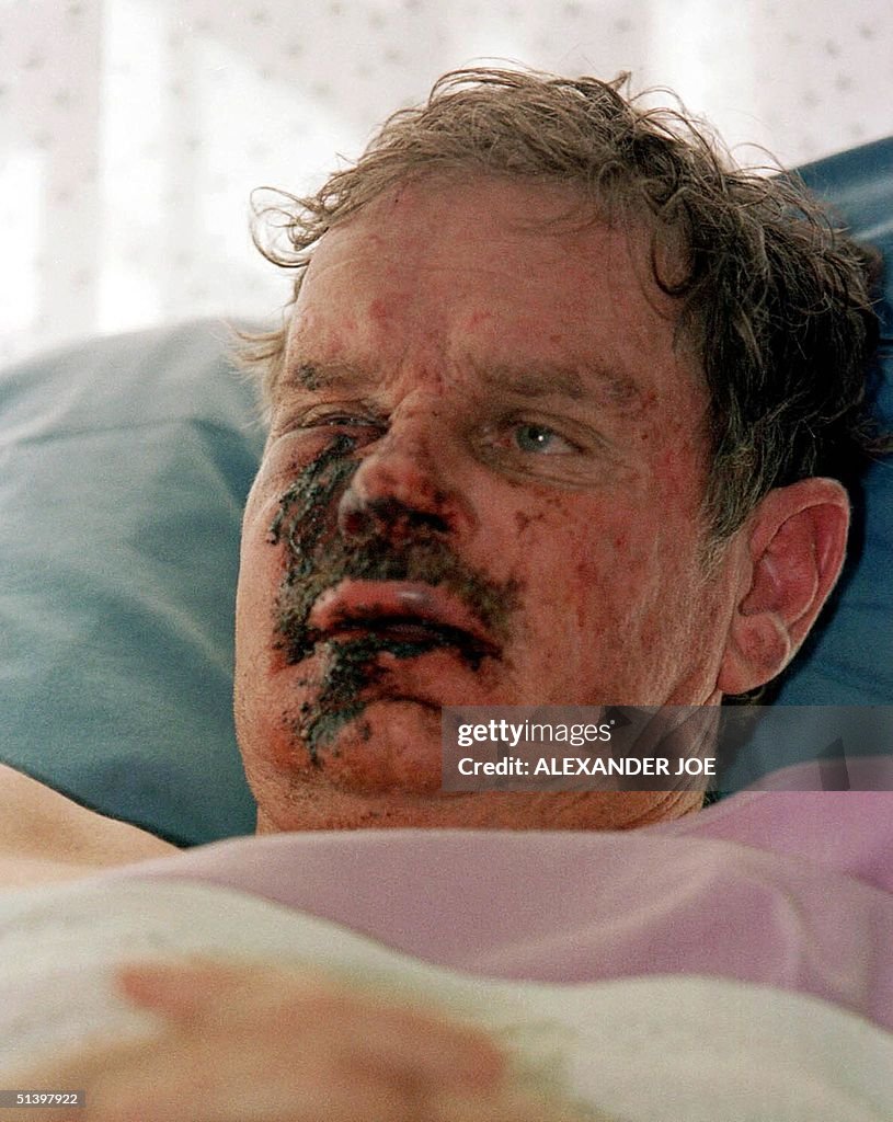 Zimbabwean farmer Steve Krynauw, who was abducted