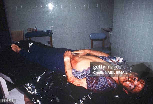 The blood covered body of US Marine Navy diver Robert Stethem lying 15 June 198 at the American hospital in Beirut after he was gunned down by the...