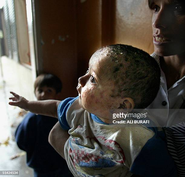 Rosa Falcone holds her ill eight-month-old Florencia as they wait for medical attention at a hospital, 27 November 2002, in Famaill?, Tucuman,...