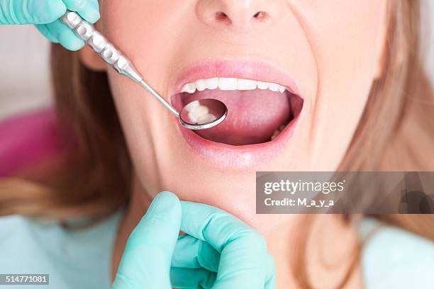 patienten besuchen zahnarzt - white teeth stock-fotos und bilder