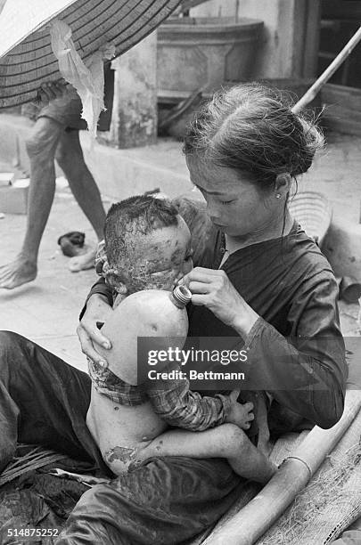 Baby burned by napalm in Operation Colorado which began in the area on August 11 sits on its mother's lap in Cam Che, Vietnam and tries to drink...