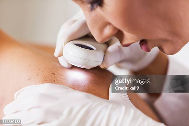 dermatologist examining patient for signs of skin cancer - doctor examining stock pictures, royalty-free photos & images