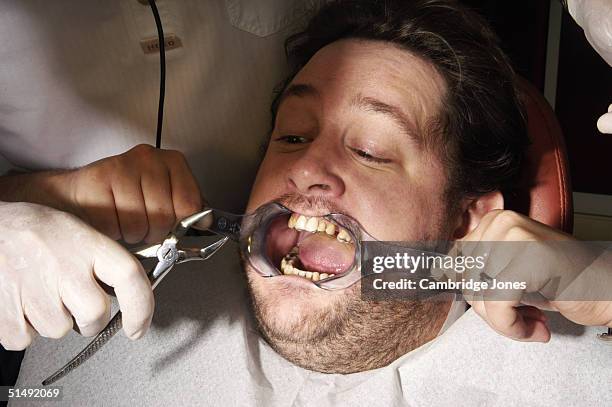Comedian Johnny Vegas poses at the dentists for a photo call held on December 2, 2003 in London.