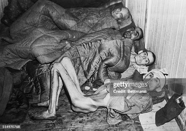 Few of the liberated prisoners of Buchenwald Concentration Camp, still showing evidence of horrific mistreatment and starvation. The man at the...