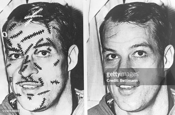 Two pictures of Detroit Red Wings hockey player Gordie Howe: the one on the left shows every facial cut he's suffered in 14 years of play, including...