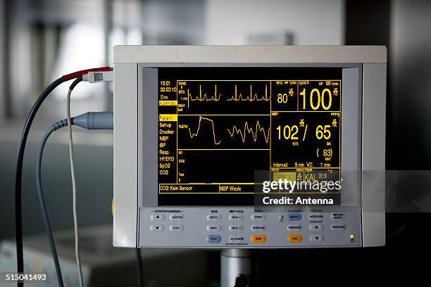 a medical monitor displaying vital signs - rythme cardiaque photos et images de collection