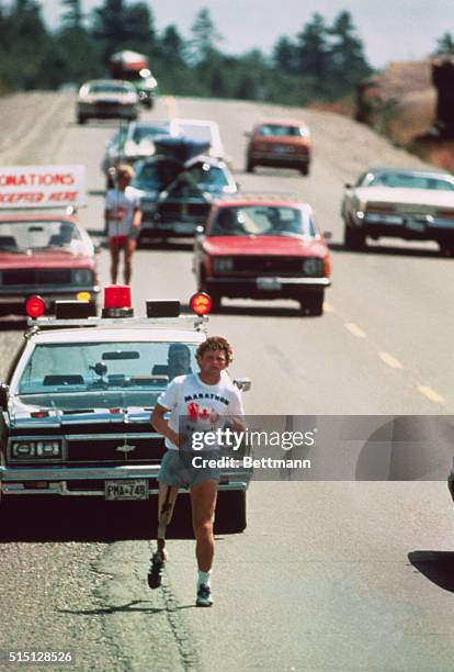 Terry Fox, age 22, is running coast-to-coast across Canada on an artificial limb, after losing his right leg to cancer three years ago, in an effort...